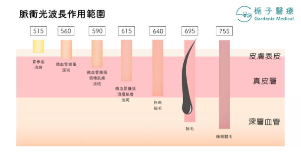 優勢1：全球唯一專利OPT™去斑嫩膚科技